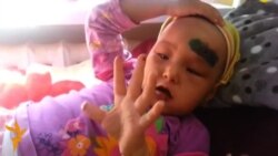 Бакчадан табылган баш оору