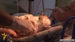 6 ամսական Սերյոժա Ավետիսյանի կյանքը փրկել չհաջողվեց