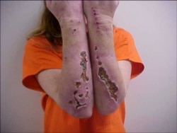 Метамфетаминчи баңгинин колдору. АКШ.