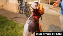 Паранены падчас пратэстащ у Менску, 10 жніўня