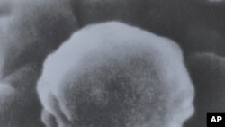 SPID-iň wirusynyň mikroskopik görnüşi. Surat 1985-nji ýylyň dekabrynda düşürilen.