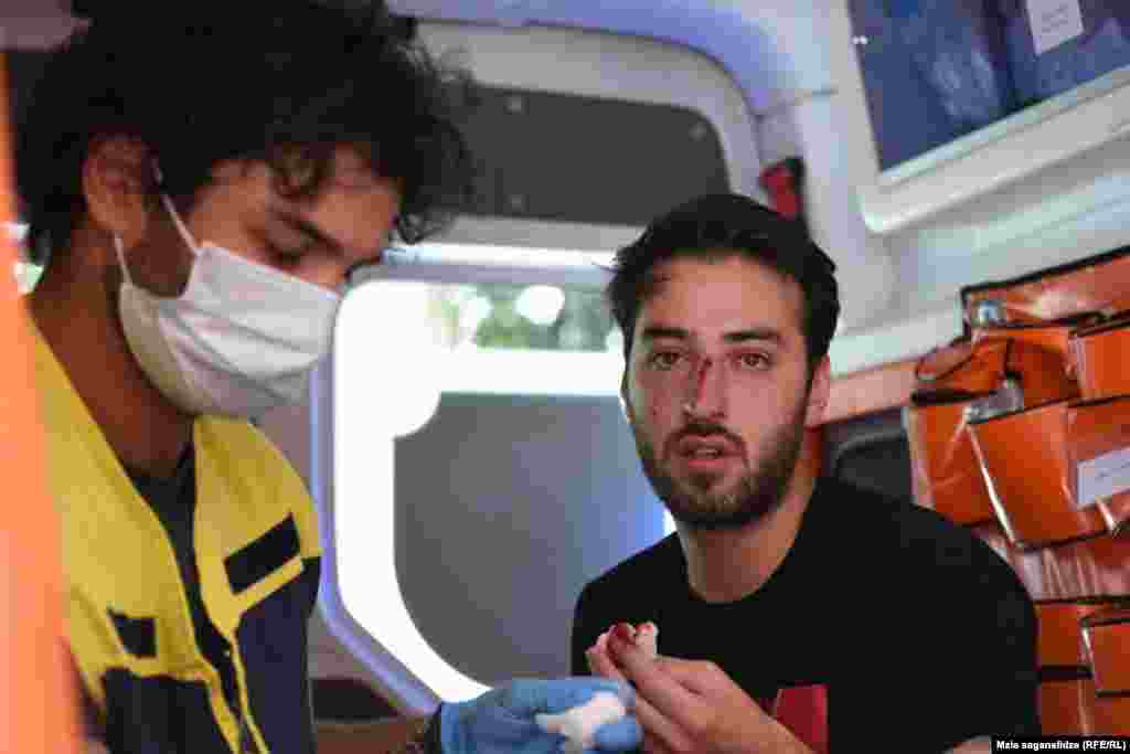 От рук радикалов пострадали 53 представителя СМИ. На фото - корреспондент грузинской службы Радио Свобода Торнике Мандария