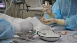 Підготовка оклюдера до введення в організм