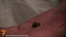 В людей стреляли из снайперских винтовок - хирург