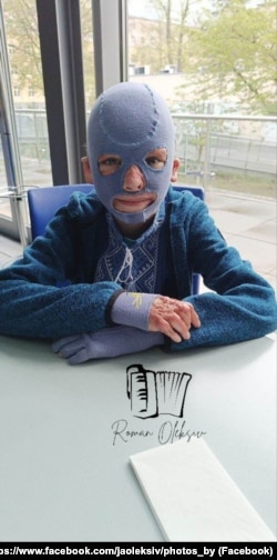 У спеціальній масці Роман ходив майже 2 роки