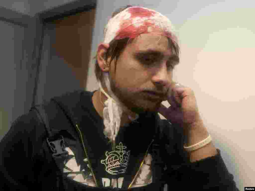 Uladzimir Nýaklýaýewiň tarapdarlarynyň biri ýenjilenden soň keselhanada. 