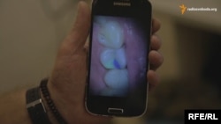 Зубна пломба в кольорах українського прапора