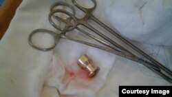 Евромәйданда яраланган кешедән алынган тимер ядрә. KyivPost хәбәрчесе Christopher Miller фотосы.