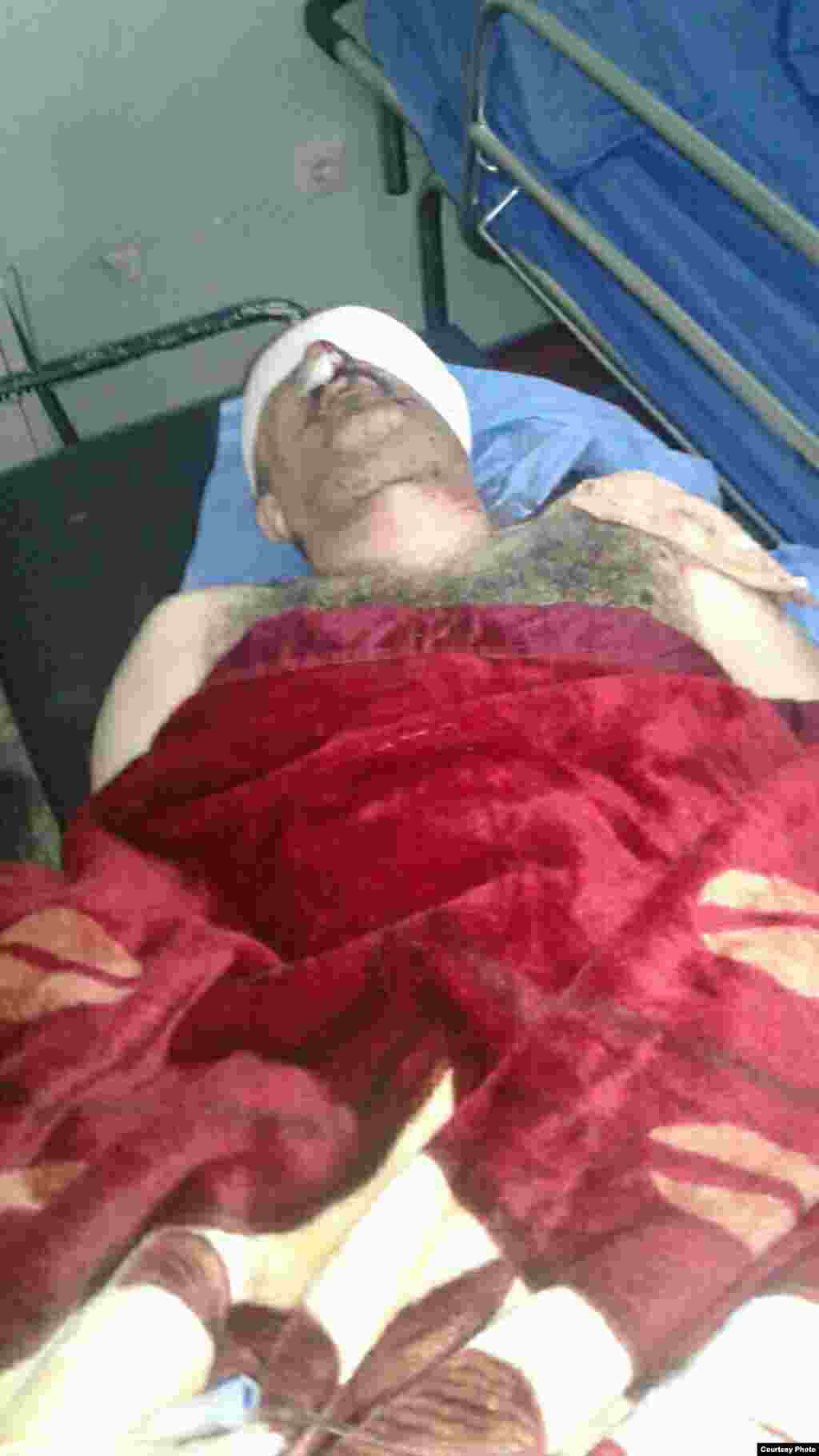 Расул Махмуд був госпіталізований у місті Ірбіль, після поранення під час атаки у Башіці, що за 24 кілометри від Мосула. Ймовірно, він був поранений під час мінометного обстрілу. Лікарі дають невеликий шанс збереження його зору.&nbsp; &nbsp;