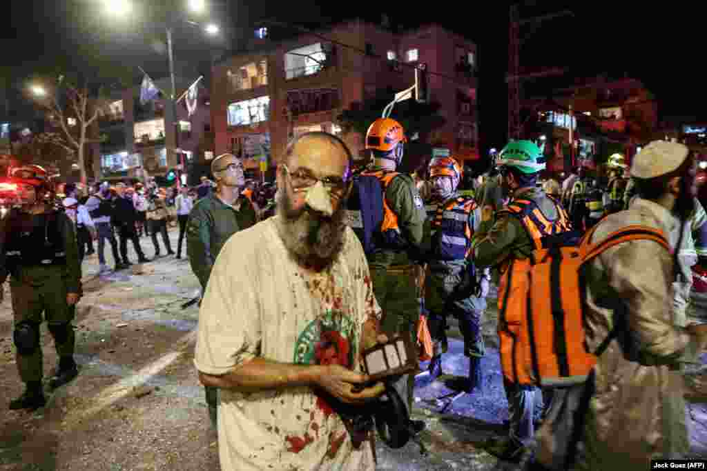 Паранены мужчына ў Рамат-Гане пасьля хвалі іранскіх удараў па Ізраілі, 13 чэрвеня 2025 году.