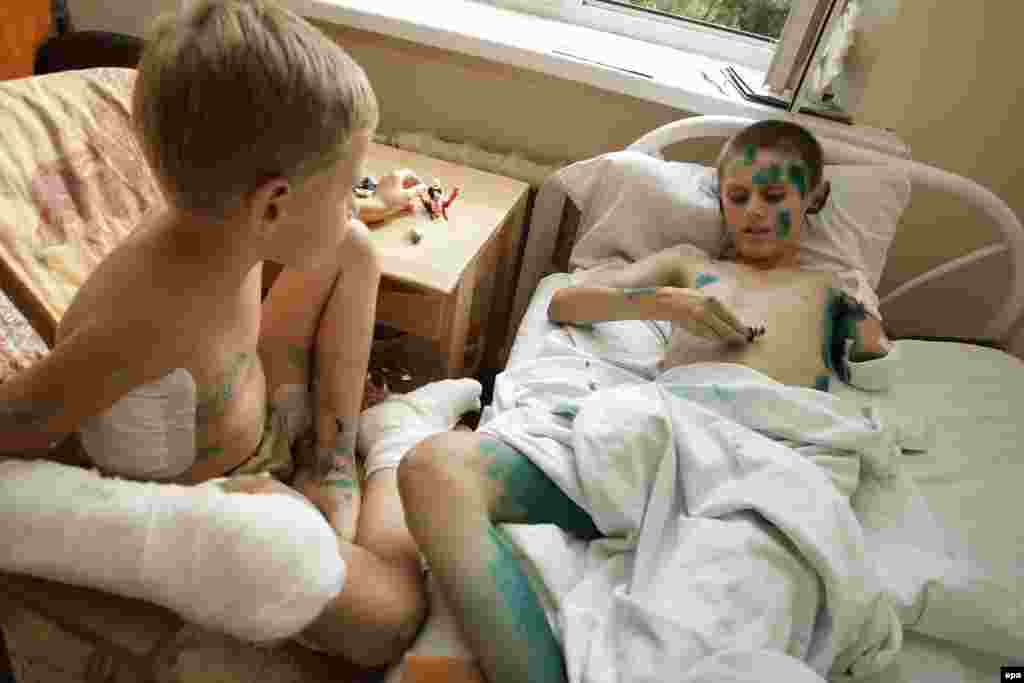 Дмитро (7 років) і Андрій (12 років) в травматологічній лікарні Донецька. Хлопці отримали поранення 7 серпня під час вибуху гранати, яку вони знайшли на полігоні бойовиків угруповання &laquo;ДНР&raquo;.​&nbsp;Фото від 15 серпня 2015 року.&nbsp; &nbsp;