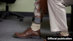 Электронный браслет для слежки за подозреваемым. Иллюстративное фото