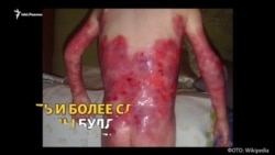 Как живут "дети-бабочки"?