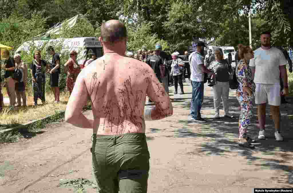 Поранений чоловік йде з місця російського ракетного удару, Дніпро, 24 червня 2025 року.У Дніпрі через атаку РФ спалахнула пожежа. Пошкоджена цивільна інфраструктура – гуртожиток, гімназія, адмінбудівля