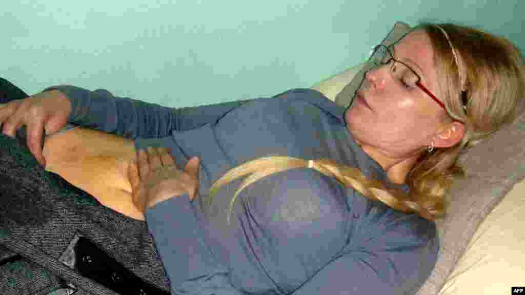 Фотографии с травмами Тимошенко, нанесенными якобы сотрудниками исправительного учреждения, уже появились в Интернете.