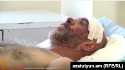 Ազատամարտիկ Սմբատ Հակոբյանը հիվանդանոցում, արխիվ