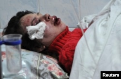 Громадська активістка і журналістка Тетяна Чорновол після нападу на неї