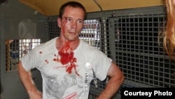 Илдар Дадин полициядә