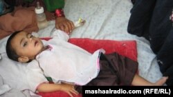 کودک مبتلا به کولرا در افغانستان