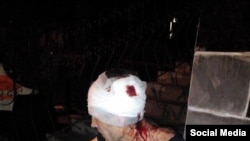 Євген Мельничук після побиття 4 серпня 2015 року