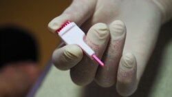 Экспресс-тест