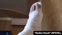 У Саидасрора во время спасения девушки была сломана нога.