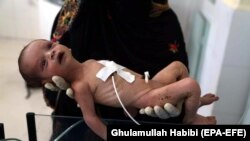 افغانستان یکی از کشورهایی با بالاترین میزان مرگ‌ومیر مادران و نوزادان در جهان است.