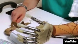 Бионикалык жасалма кол.