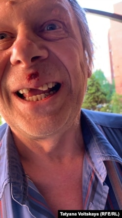 В результате конфликта соседу выбили зубы