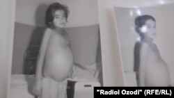 Акс аз бойгонӣ: кӯдакон бо варами ҷигар дар солҳои ҷанги дохилии Тоҷикистон