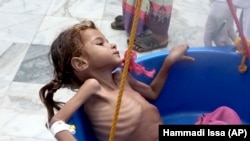 Йемендеги ачарчылыктын азабын тарткан көчөт кыз.
