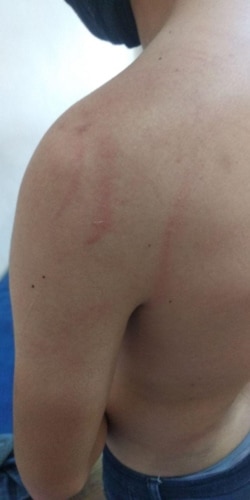 Довар Джуракулов утверждает, что сотрудники Нацгвардии применяли к ним физическую силу за отсутствие маски.