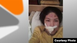 Пострадавшая Гүлназ Калмурзаева.