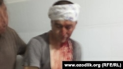 24 yoshli fermer G‘olibjon Ibragimov o‘zi va uch hamkasbini noma’lum shaxslar 6 - iyun kuni qattiq kaltaklaganini aytmoqda.