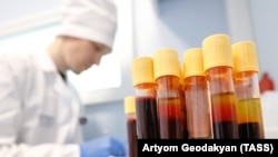 ВИЧке алынган анализдер. 