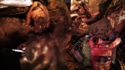 «Мої люди виконують свою роботу, не дивлячись на перевагу противника в усіх компонентах»