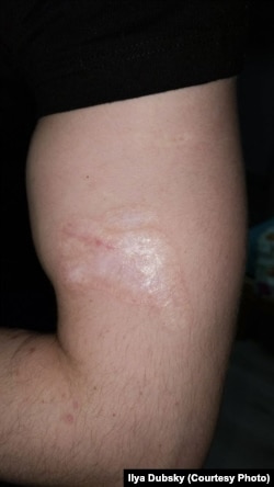 Месца, дзе было тату з Пагоняй, Ільля Дубскі