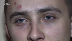 Били чимось схожим на биту – Стерненко про обставини свого побиття (відео)