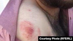 داکتر لت‌وکوب شده در شفاخانه افغان-جاپان