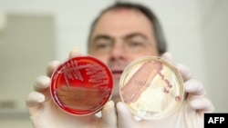 Профессор Гельмут Фикеншер: сальмонелланын бактериясы антибиотиктерди тоотпой калган, Киель, Германия, 01.06.2011.