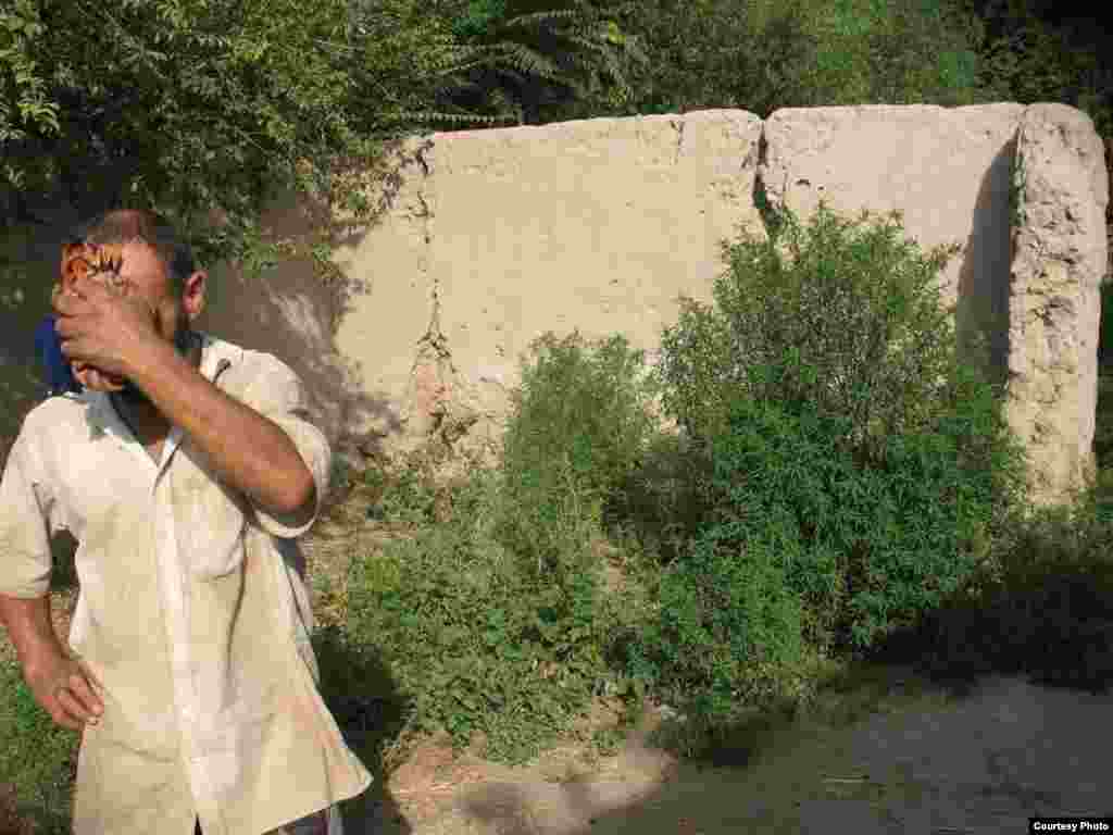 Раны от пережитой войны еще не зажили