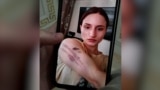 Фотография Айшат Баймурадовой со следами домашнего насилия