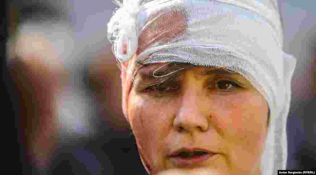 Муниципального депутата Александру Парушину ударили дубинкой по голове, она потеряла сознание.