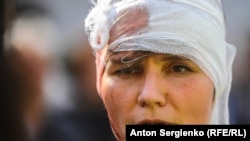 Полиция задерживает и бьет людей в Москве на акции «За честные выборы». 