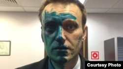 Олексій Навальний після нападу, Москва, Росія, 27 квітня 2017 року