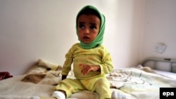 Йемендеги оорукана. Архивдик сүрөт