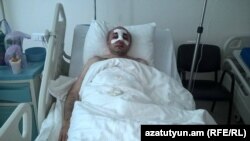 Айк Ханумян в отделении реанимации, 6 июня 2016 г.