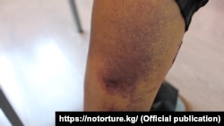 Барымтага алынган кыргызстандык.