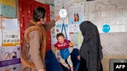 کودک دچار سو تغذیه در افغانستان