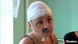 Жертва насилия Ирина Крашкова. Украина, 2013. Иллюстративное фото. 